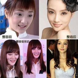 西安整容爆料事件視頻最新,揭秘行業(yè)亂象，患者權益引關注